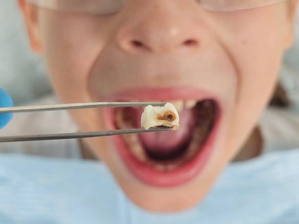 Best Emergency Dental Care for Trauma or Injury in Carrboro, NC